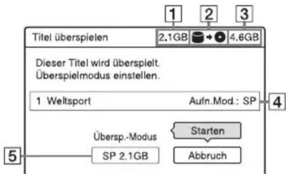 SONY DARX1 - Überspielen eines Titels (Titel überspielen) - 1