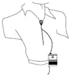 SAMSON UM1 Micro - Aufbau und Betrieb des UM1 - 1