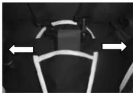 Topmark 2 Combi T8030 - FIXATION DU REPOSE-PIEDS - 1