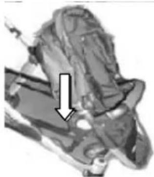 Topmark 2 Combi T8030 - ÖFFNEN DES KINDERWAGENS - 5