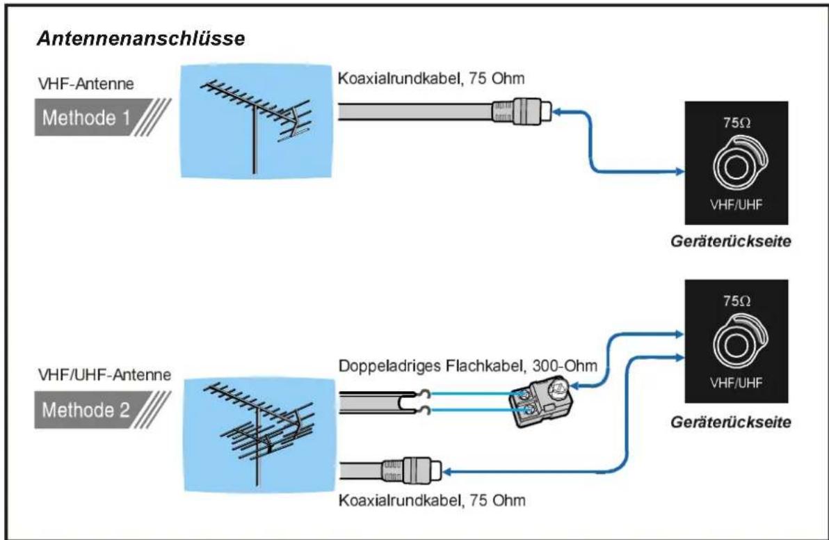 DUAL DTFT 301 - Antennenanschluss - 1