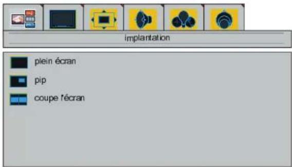 DUAL DTFT 301 - Menu "implantation" - 1