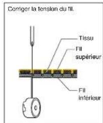 BABY LOCK Quilters Choice Professional BLQP - Tension des fils - 1