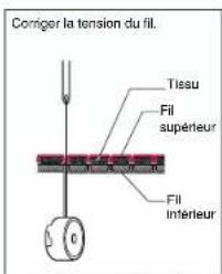 BABY LOCK Jane BL500A - Tension des fils - 1