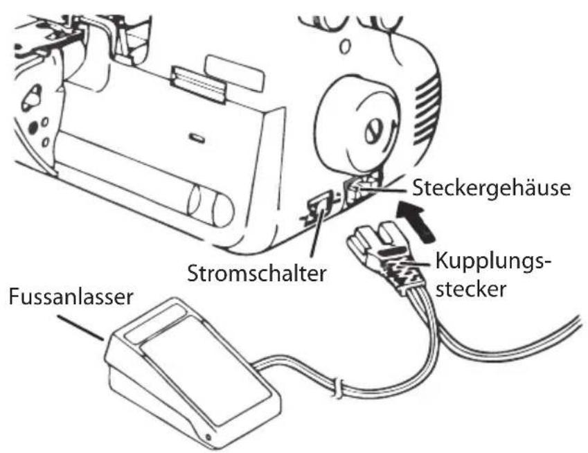 Micromaxx MD16600 - Fußanlasser anschließen - 1