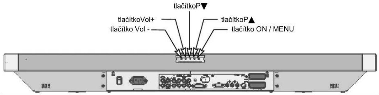 MEDION MD42598 - Ovladaci tlačitka na zařizení - 1