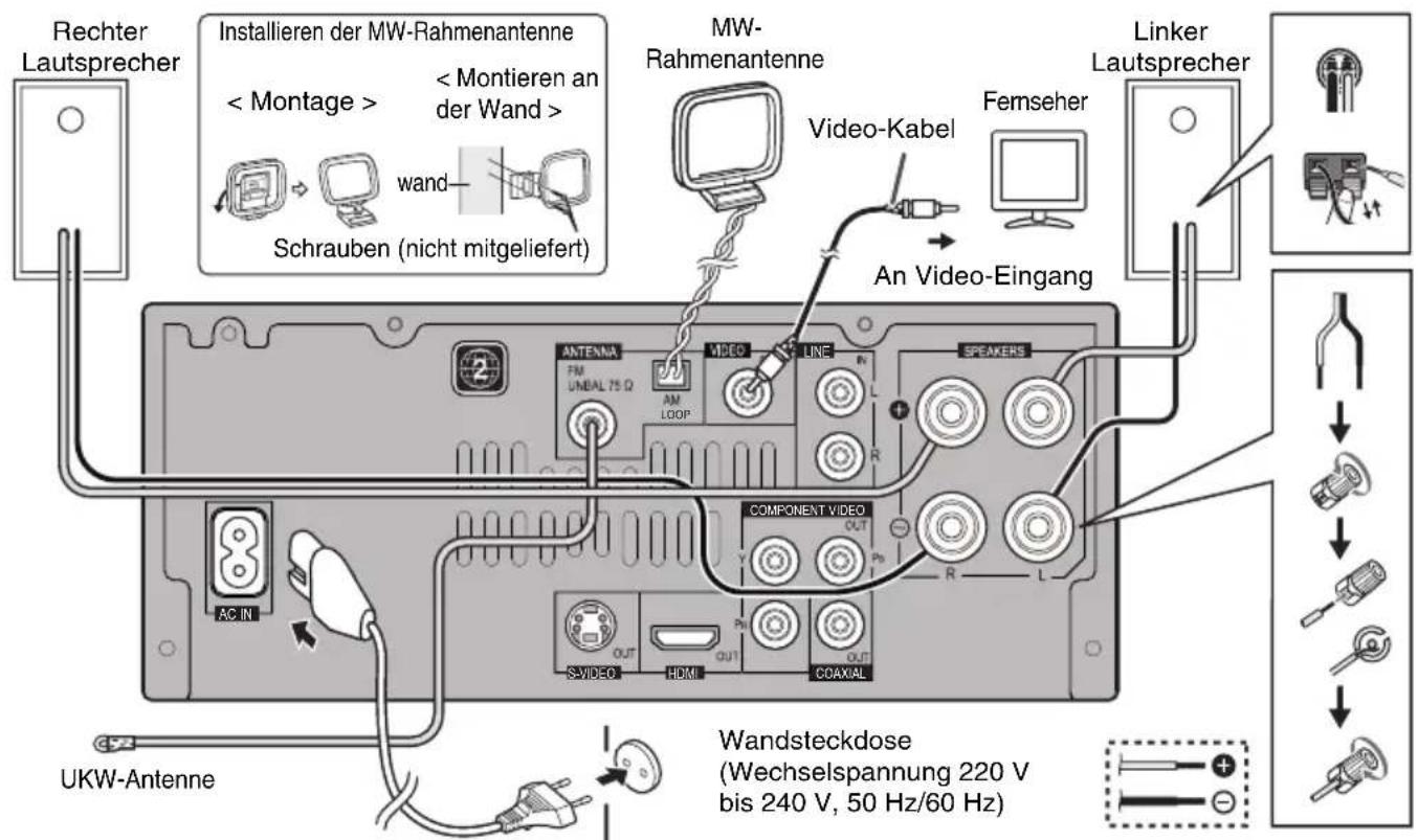 PIONEER XHM30V - ■Auf DVD-Discs verwendete Icons - 1