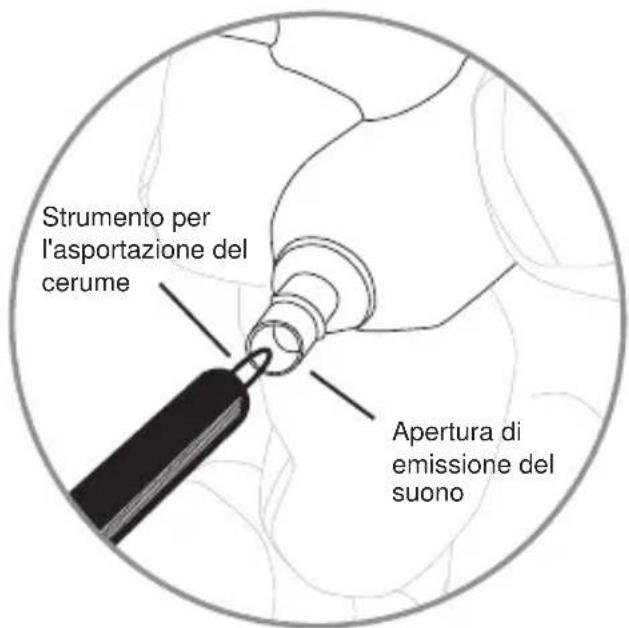 SHURE SE535LTD - Pulizia dell'ugello dell'auricolare - 1