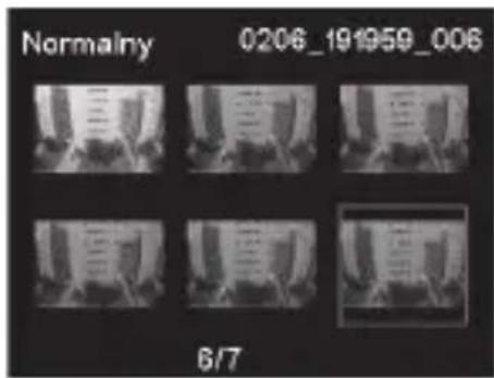 PHILIPS ADR810 - Zabezpieczanie filmów - 1
