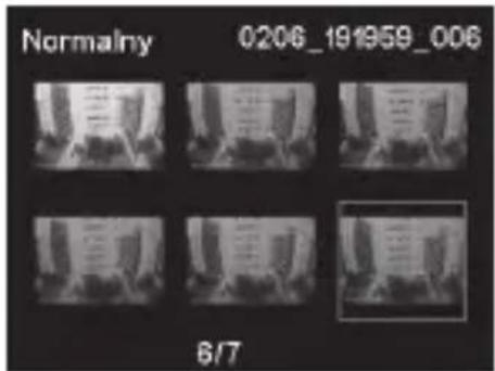 PHILIPS ADR810 - Odtwarzanie filmów - 3