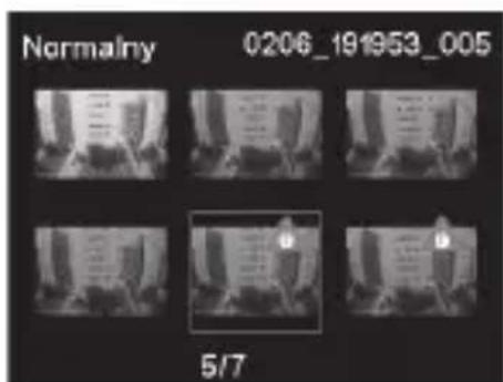 PHILIPS ADR810 - Zabezpieczanie filmów - 3