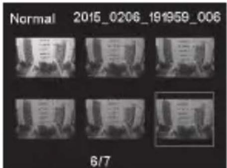 PHILIPS ADR810 - Inhaltsverzeichnis - 1