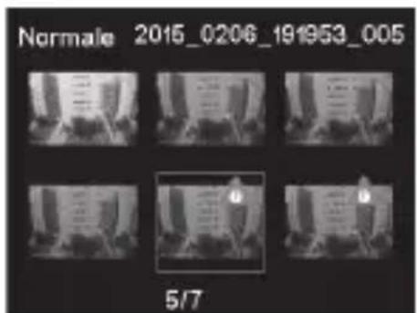 PHILIPS ADR810 - Protezione dei video - 3