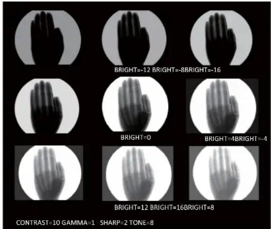 SONY UP991AD - Fonction de réglage aisé de la qualité d'image - 1