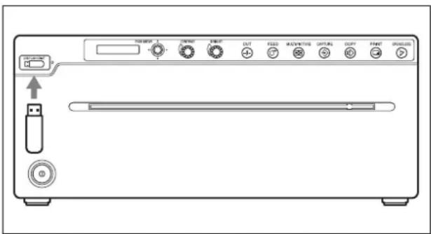 SONY UP991AD - Remarque - 1