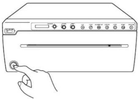 SONY UP991AD - Remarques - 1