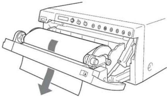 SONY UP991AD - Remarque - 1