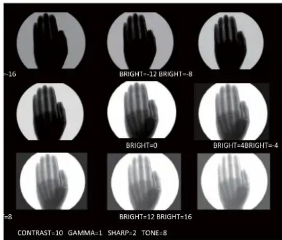 SONY UP991AD - Pour régler facilement la qualité d'image - 1