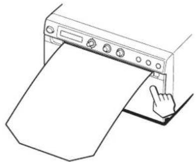 SONY UPD898MD - Remarque - 5