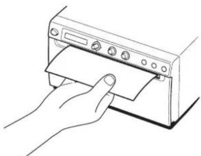 SONY UPD898MD - Nettoyage du rouleau - 1