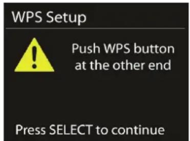 Auna Connect 150 - - Push button - 1