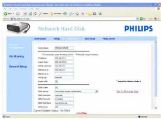 PHILIPS SPD8015 - Qu'est-ce que DDNS? - 1
