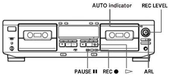 SONY TCWE525 - Adjusting the Recording Level Automatically (Auto Rec Level) - 1