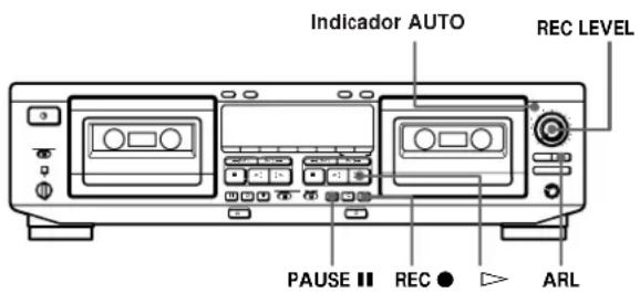 SONY TCWE625 - Ajuste automático del nivel de grabación (Nivel de grabación automático) - 1