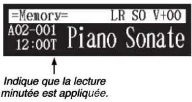 YAMAHA DC1E3 PE - Au sujet de l'écran de lecture de chanson - 1