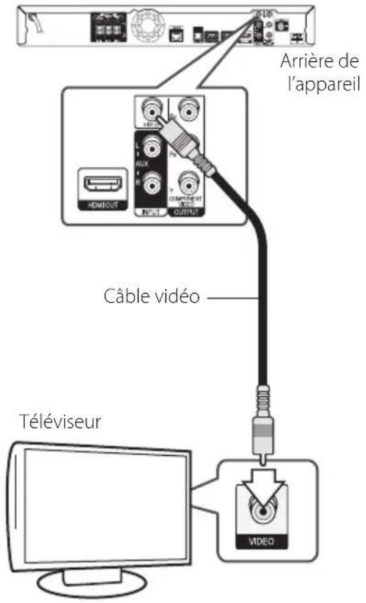 PIONEER HTZBD91HW - Connexion vidéo - 1