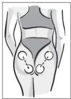 MEDISANA BTS 47728 - HINWEIS - 2