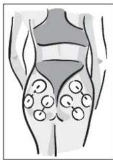 MEDISANA BTS 47728 - NOTA - 3