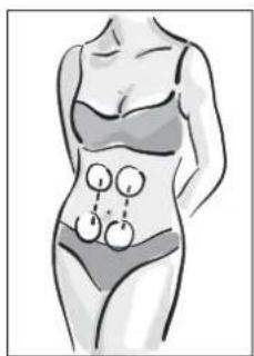 MEDISANA BTS 47728 - HINWEIS - 4