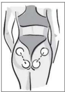 MEDISANA BTS 47728 - YINOAEIH - 2