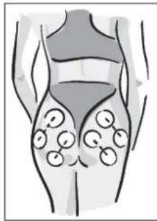 MEDISANA BTS 47728 - NOTA - 3