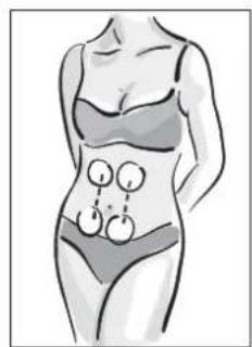 MEDISANA BTS 47728 - AANWJZING - 4