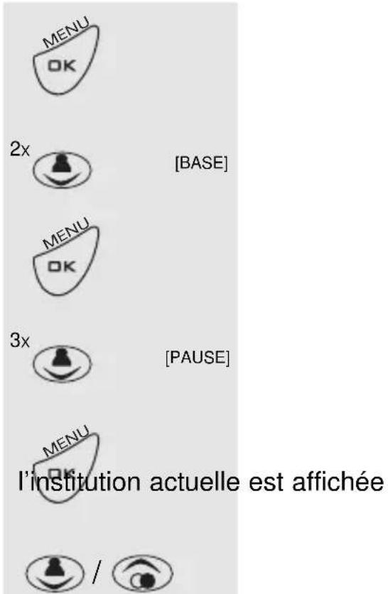 PROFOON PDX2428 - DUREE DE PAUSE POUR UN PAUSE DE CHOIX : - 1