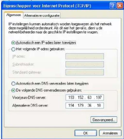 SILVERCREST MR 6100x - De netwerkinstellungen onder Windows weergeven - 1