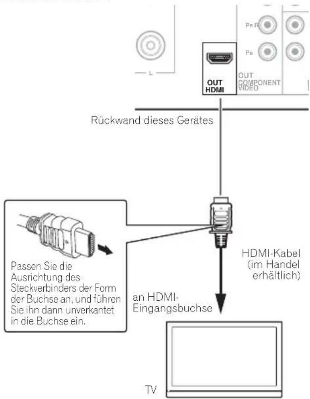 PIONEER XHM32VS - HOMI - 1