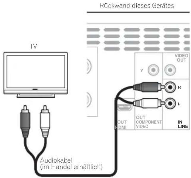 PIONEER XHM32VK - Hinweis - 1