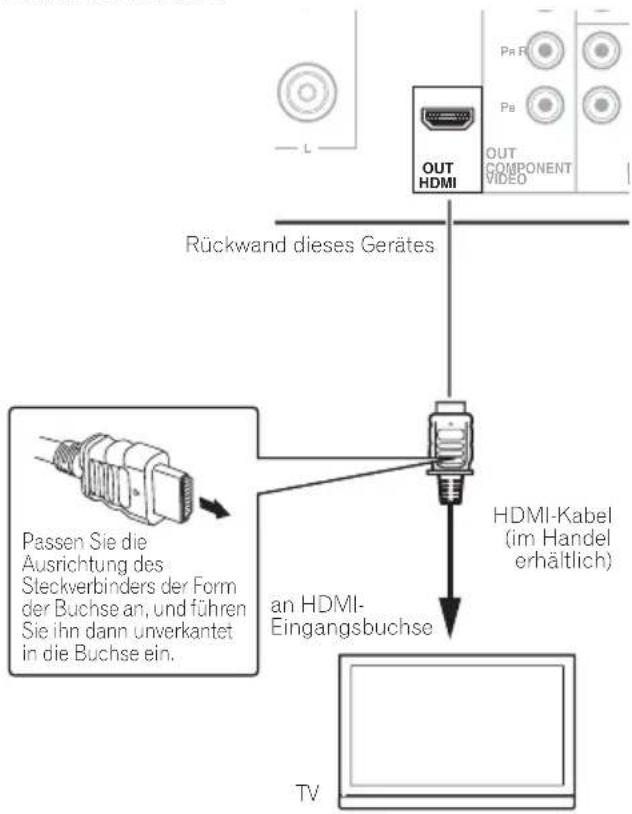 PIONEER XHM32VK - HOMI - 1