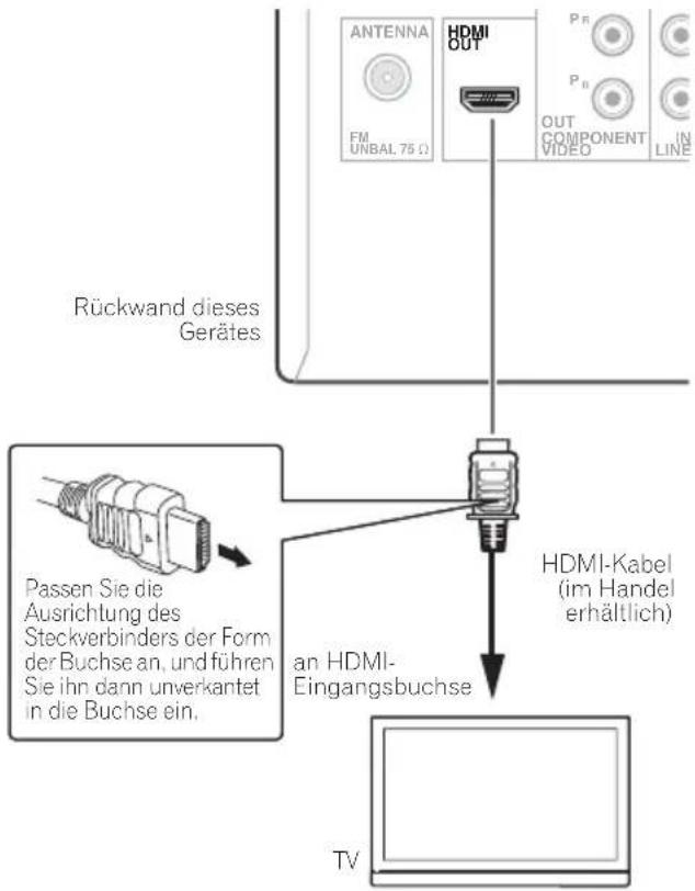 PIONEER XCM52BTK - HOMI - 1