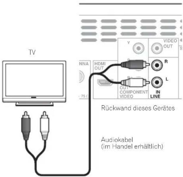PIONEER XCM52BTK - Hinweis - 1