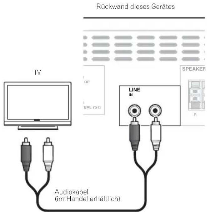 PIONEER XCM32BTK - Hinweis - 1