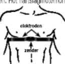 Ciclo CP 12L Puls - Zender en hartslagmeterhorloge omdoen. - 1