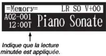YAMAHA Diskklavier E3 Classic - Au sujet de l'écran de lecture de chanson - 1