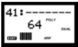YAMAHA AN1X - Assign 1-8 (assignation) - 1
