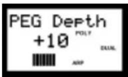 YAMAHA AN1X - PEG depth (profondeur PEG) - 1