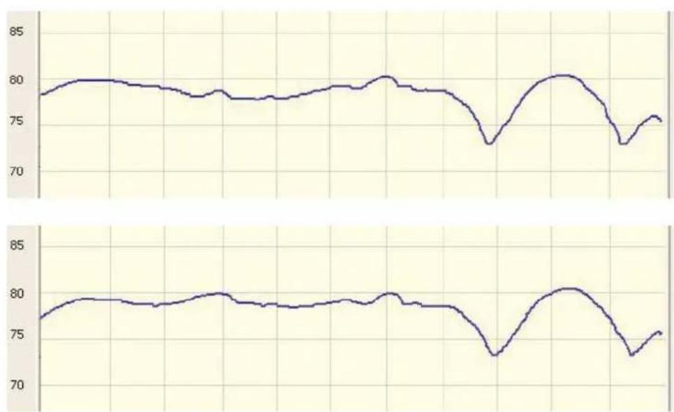 VELODYNE DD18plus - Exemple de modification de réponse en fréquence due à un changement d'emplacement d'un caisson de basses - 3