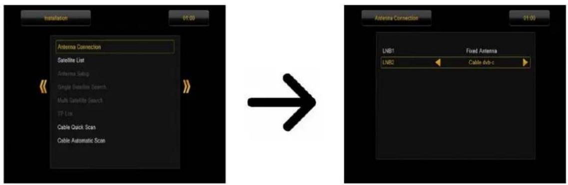 Ferguson Ariva 253Combo - télévision par cable (uniquement pour les modèles 153 Combo et 253Combo) - 1